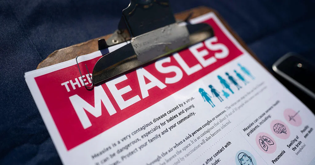 Los Angeles County confirms seventh measles case of the year