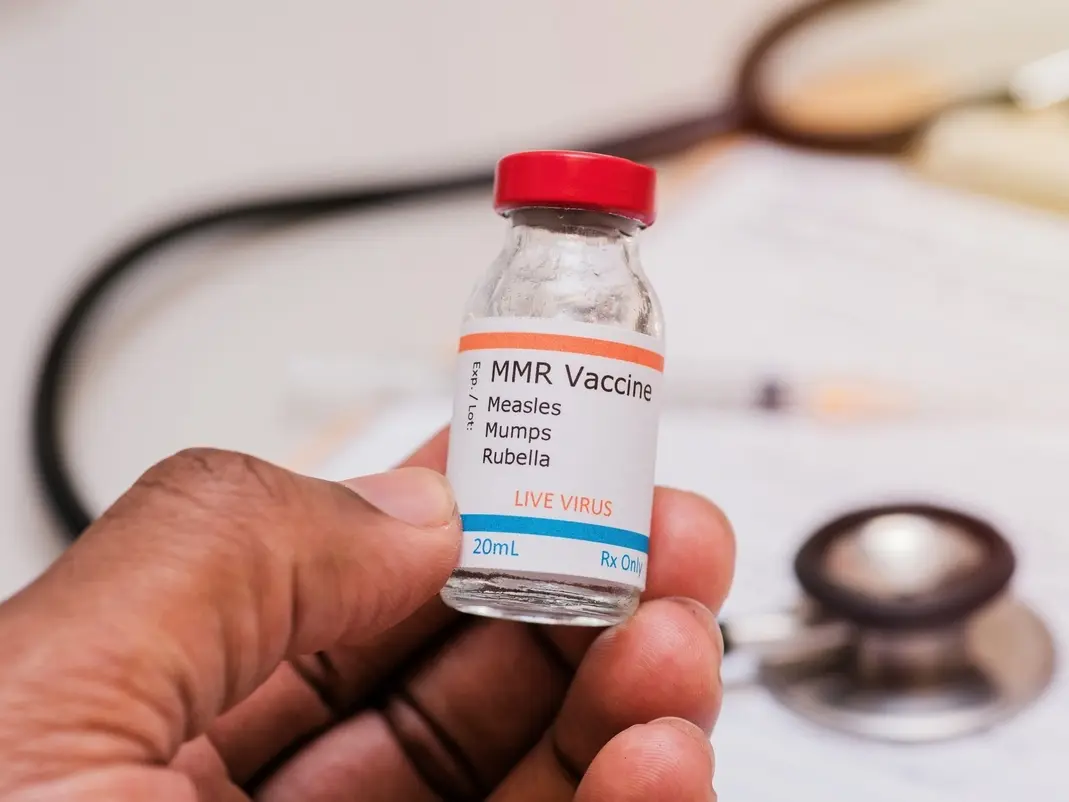 Measles Outbreak: New Case Confirmed In LA County
